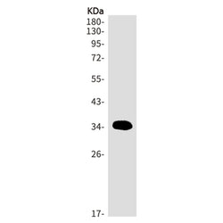 HSD17B1 rabbit monoclonal antibody