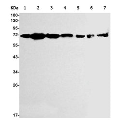 HSPA8 rabbit monoclonal antibody