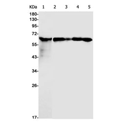 HSPD1 rabbit monoclonal antibody