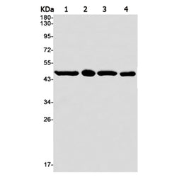 IDH1 rabbit monoclonal antibody