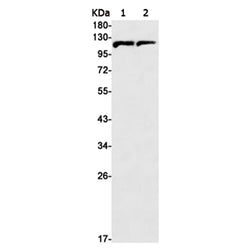 IFNAR1 rabbit monoclonal antibody