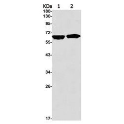 IGF2BP1 rabbit monoclonal antibody