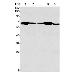 IGF2BP3 rabbit monoclonal antibody