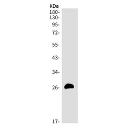 IGFBP1 rabbit monoclonal antibody