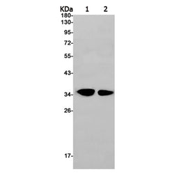 IGFBP6 rabbit monoclonal antibody