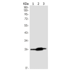 Human kappa Light Chain rabbit monoclonal antibody