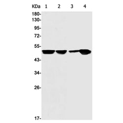 IKBKG rabbit monoclonal antibody