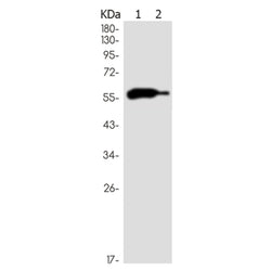 IKZF3 rabbit monoclonal antibody