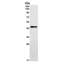 IL11RA rabbit monoclonal antibody