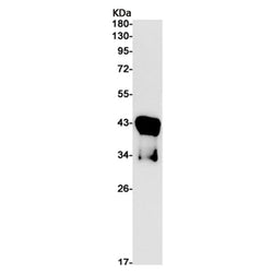 IL4 rabbit monoclonal antibody