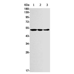 ILK rabbit monoclonal antibody