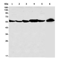 IMPDH2 rabbit monoclonal antibody