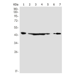 ING1 rabbit monoclonal antibody