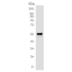 IRF5 rabbit monoclonal antibody