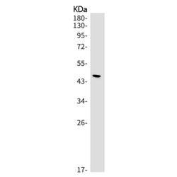IRF8 rabbit monoclonal antibody