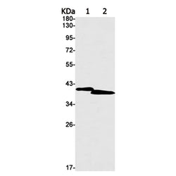ISL1 rabbit monoclonal antibody