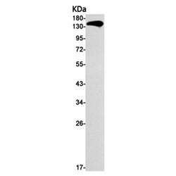 ITGA2 rabbit monoclonal antibody