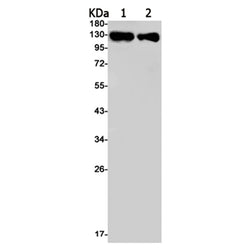 ITGAV rabbit monoclonal antibody