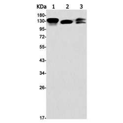 ITGB1 rabbit monoclonal antibody