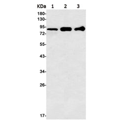 ITGB5 rabbit monoclonal antibody