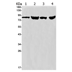 ITGB6 rabbit monoclonal antibody