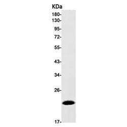 ITPA rabbit monoclonal antibody