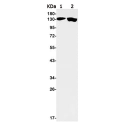 JARID2 rabbit monoclonal antibody