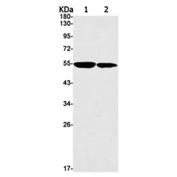 KATNA1 rabbit monoclonal antibody