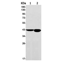 KCTD9 rabbit monoclonal antibody