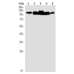 KIF11 rabbit monoclonal antibody