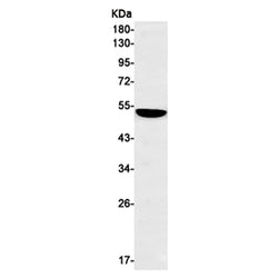 KRT16 rabbit monoclonal antibody