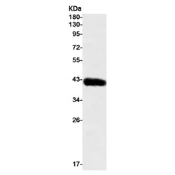KRT19 rabbit monoclonal antibody