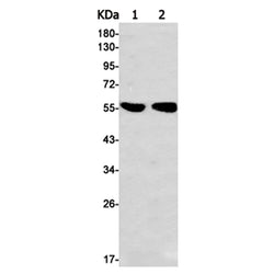 KRT4 rabbit monoclonal antibody