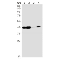 L1RE1 rabbit monoclonal antibody
