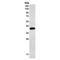 LAT (phospho-Tyr200) rabbit monoclonal antibody