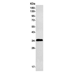 LAT rabbit monoclonal antibody