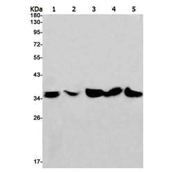 LDHA rabbit monoclonal antibody