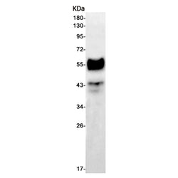 LEF1 rabbit monoclonal antibody