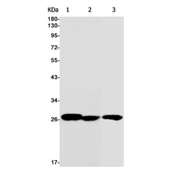 LGALS3 rabbit monoclonal antibody
