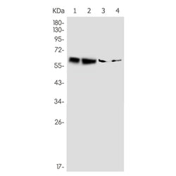 LGI1 rabbit monoclonal antibody