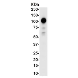 LOXL2 rabbit monoclonal antibody