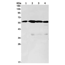 LUM rabbit monoclonal antibody