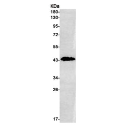 MAGEA3 rabbit monoclonal antibody