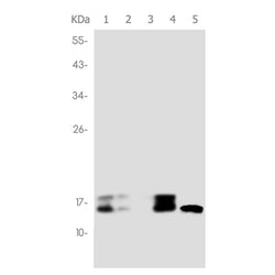 MAP1LC3A rabbit monoclonal antibody