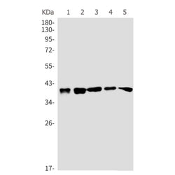 MAP2K3/MAP2K6 rabbit monoclonal antibody