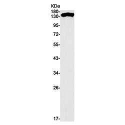 MAP3K5 rabbit monoclonal antibody