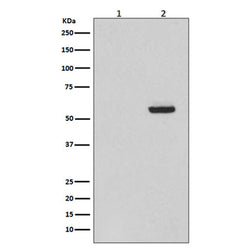 MAPT (phospho-Ser396) rabbit monoclonal antibody