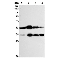 MBD2 rabbit monoclonal antibody