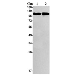 MCAM rabbit monoclonal antibody
