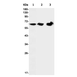 ME2 rabbit monoclonal antibody